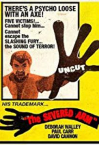 The Severed Arm