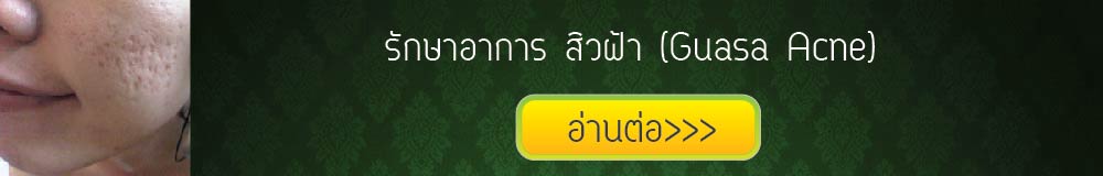 กัวซารักษาอาการสิวฝ้า
