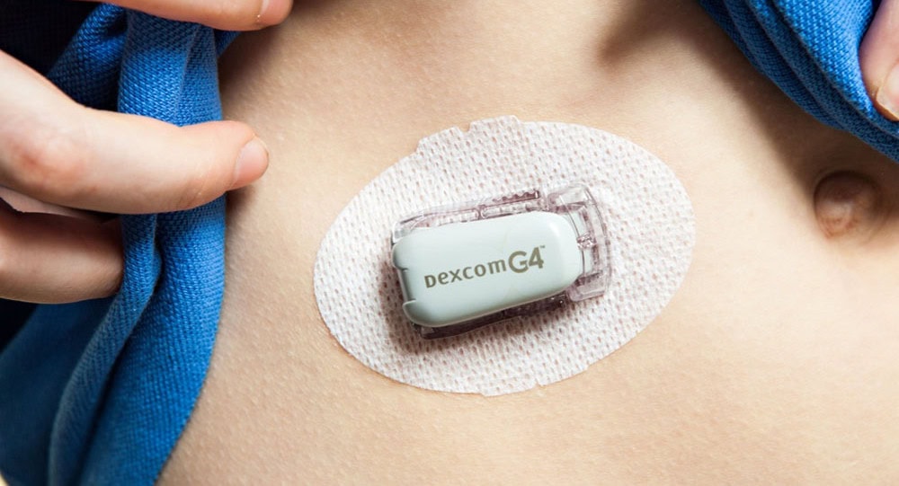 Continous Glucose Monitor