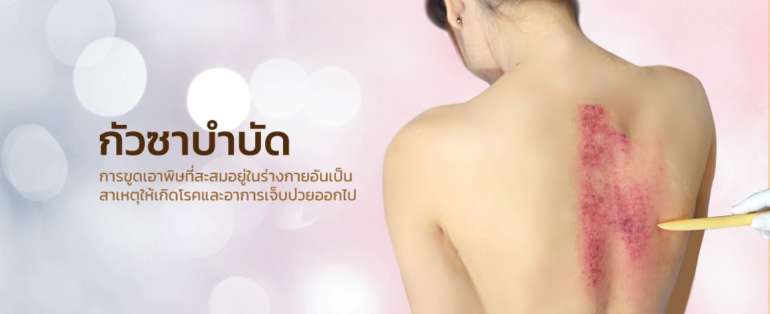 กัวซา บำบัดโรค