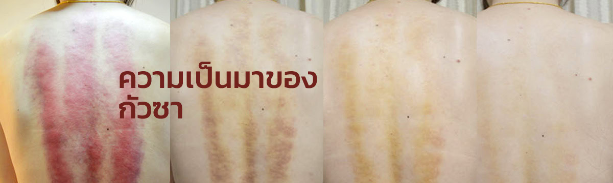 ความเป็นมาของกัวซา