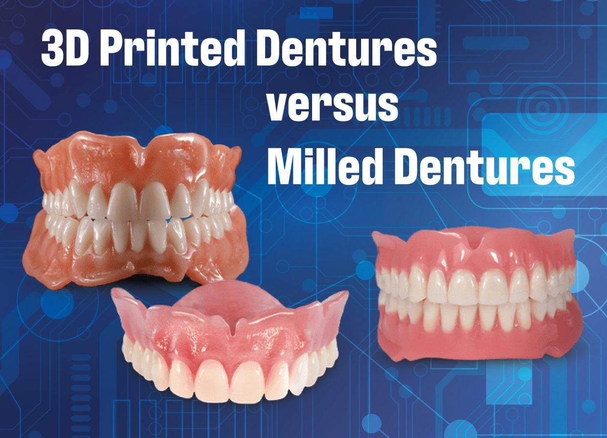 3D Printed vs. Milled Dentures Elegant Lab