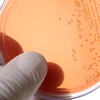 shutterstock_5927647_petri_dish_200px