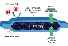 Photo of Will ViaCyte’s Encaptra Cell Delivery System ‘Cure’ Type 1 Diabetes?