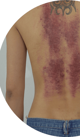 พิษในร่างกาย