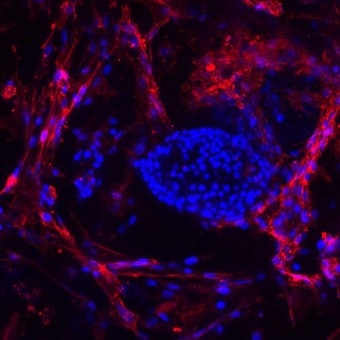 016_Silicone_Scaffolds_MSC_Islets_S1_20x