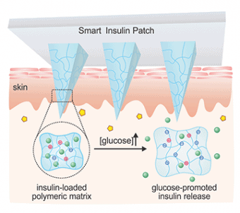 Schematic mechanism of glucose-responsive smart insulin patch. (Credit: Zhen Gu Lab/UCLA)