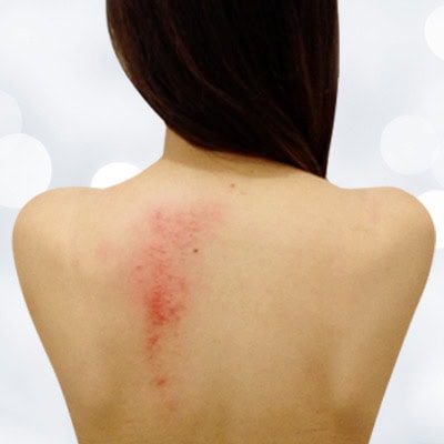 กัวซาขับพิษ