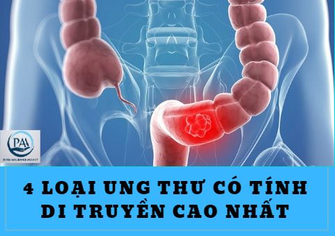 4 loại ung thư có tính di truyền cao nhất