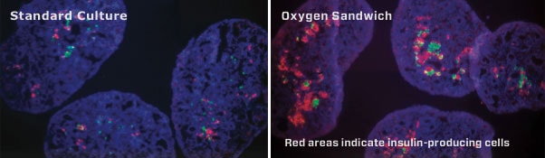 oxygen-sandwich