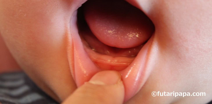 いろいろ満載な日② 下の歯見えてきた！