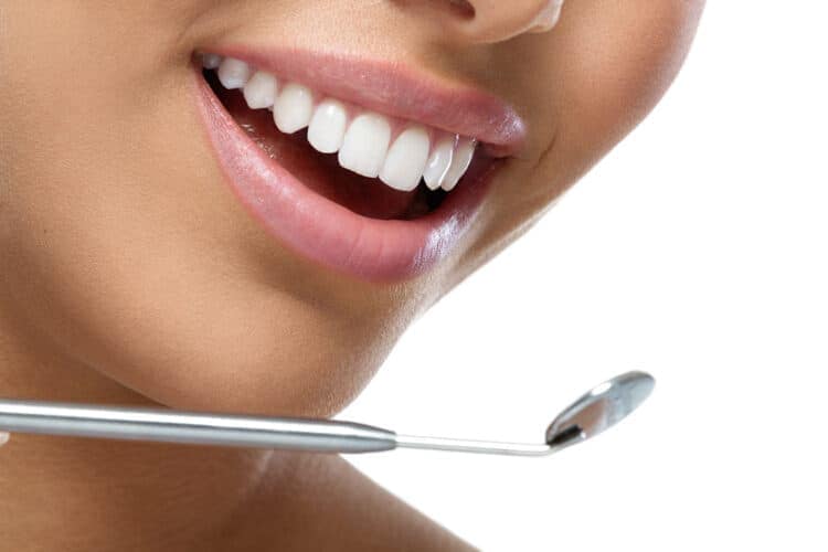 Hollywood Smile