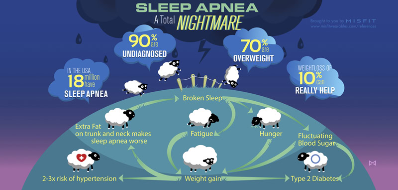 039_sleep_apnea_infographic