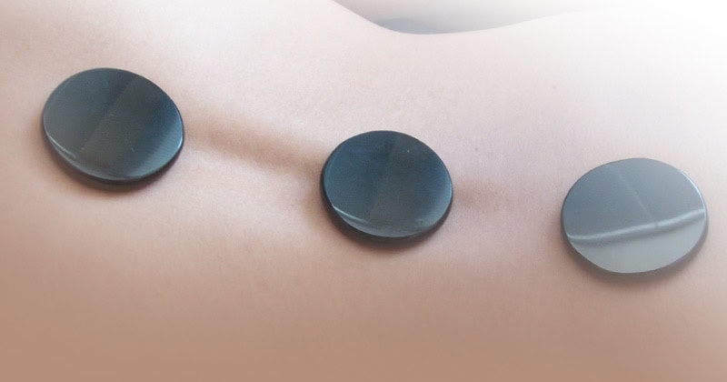 กวาซา หรือการขูดพิษ