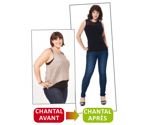 avant-apres