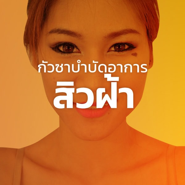 กัวซารักษาอาการสิวฝ้า