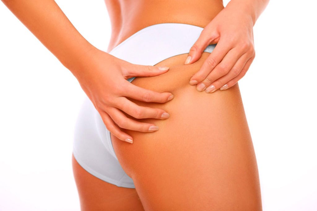 Vacumterapia en Gluteos Vacumterapia en Gluteos