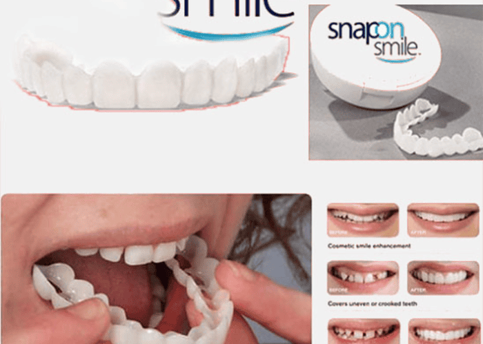 Image annonce: Hollywood smile