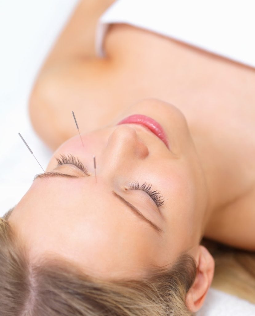 acupuntura estetica