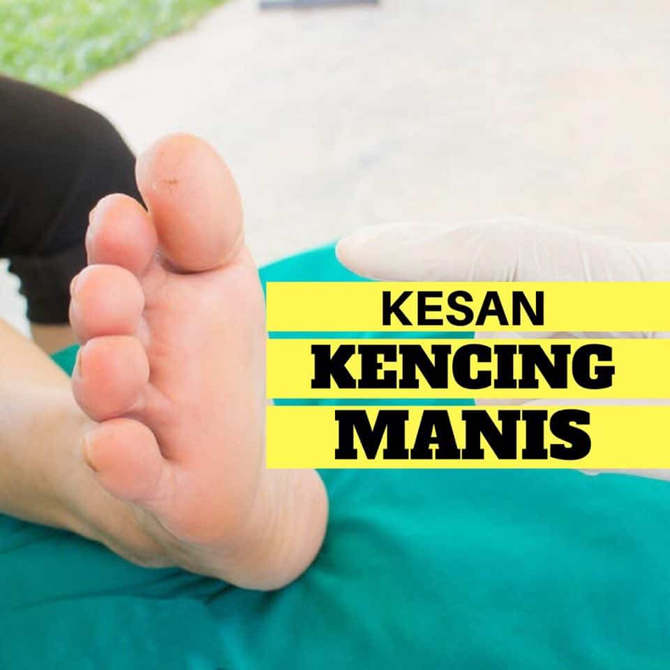 KESAN-KESAN BURUK KENCING MANIS