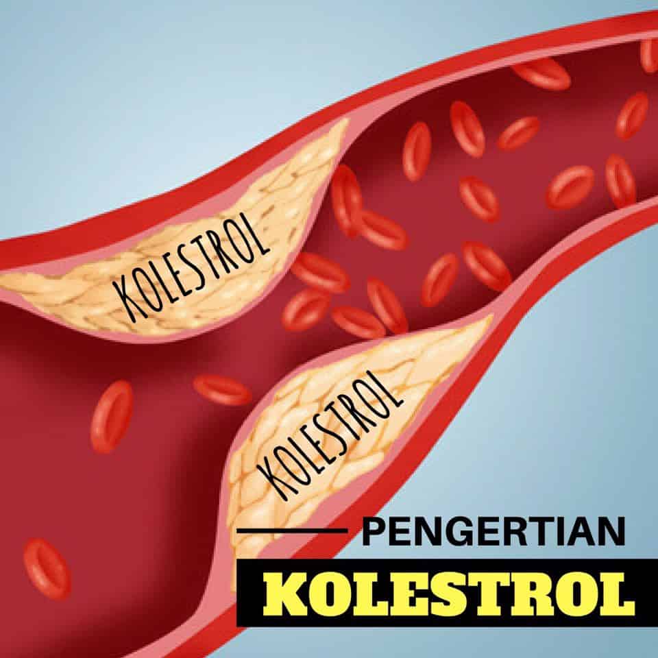 MEMAHAMI BACAAN KOLESTEROL DALAM UJIAN DARAH