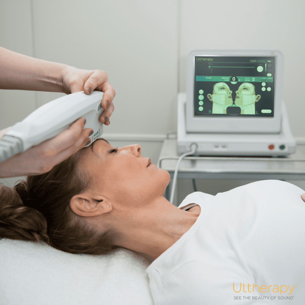 ultherapykvinde