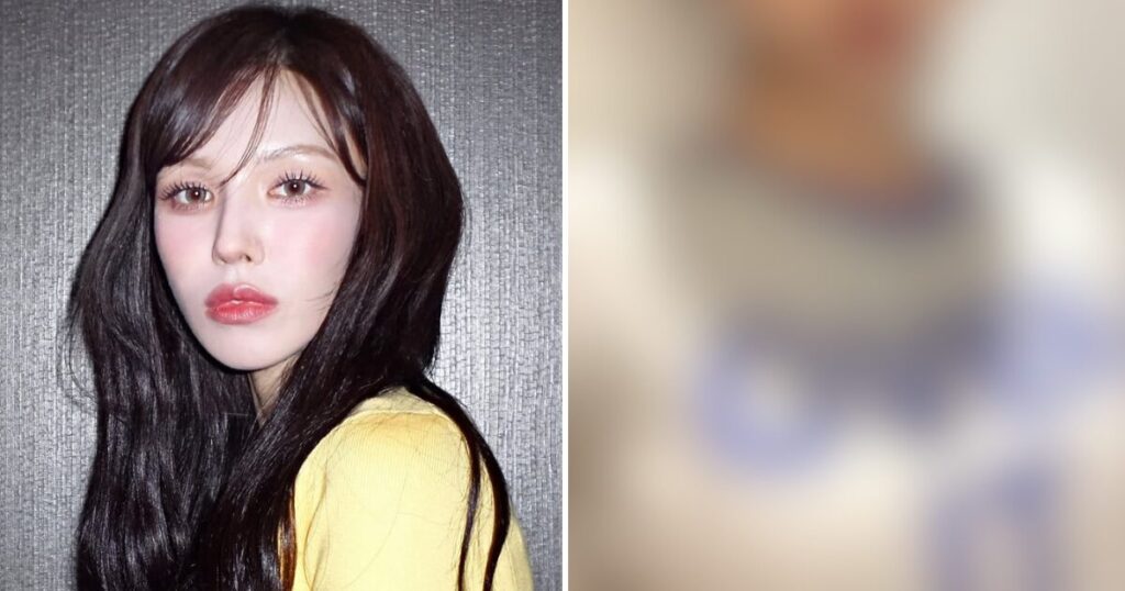 Foto Wendy Red Velvet Picu Gosip Editing dan Operasi Plastik