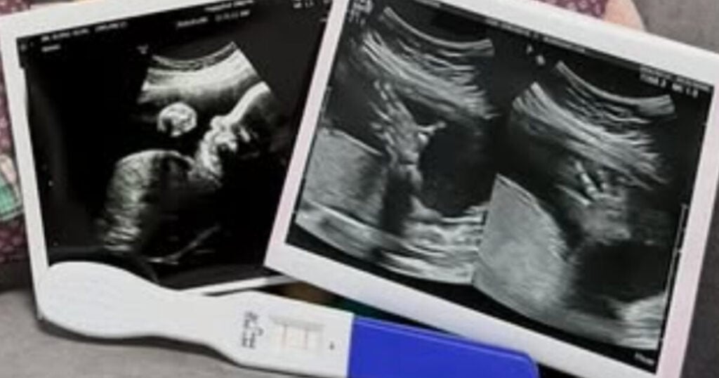 Kabar Bahagia: Model Cantik Ini Umumkan Kehamilan Setelah Dua Bulan Menikah