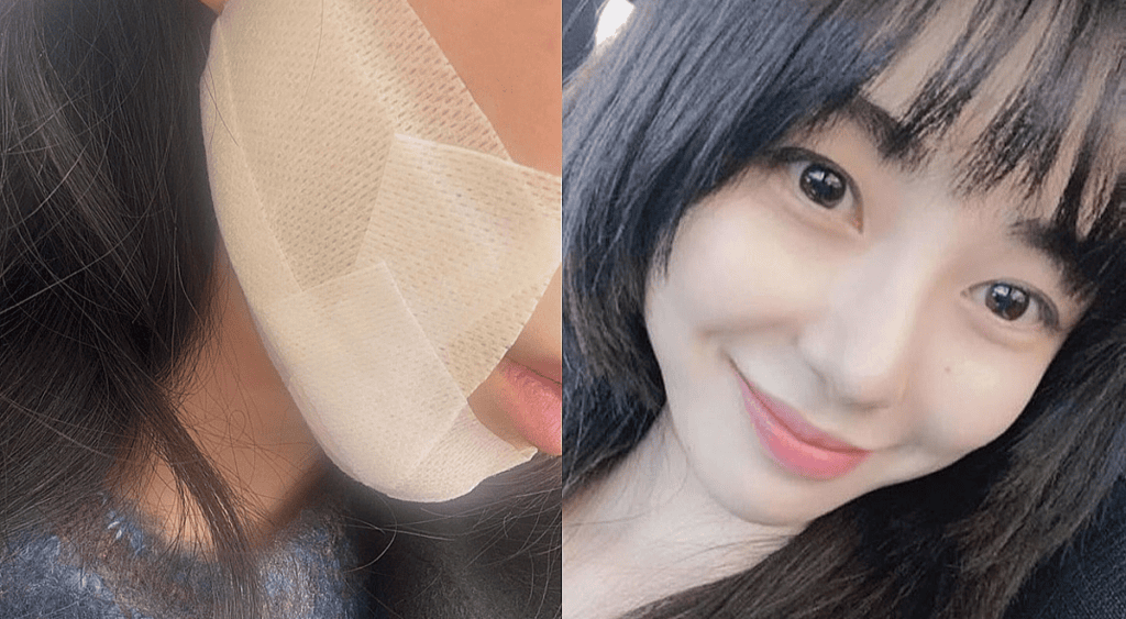 Kwon Mina Comeback Jadi Konsultan Klinik, Siap Bantu Pasien!