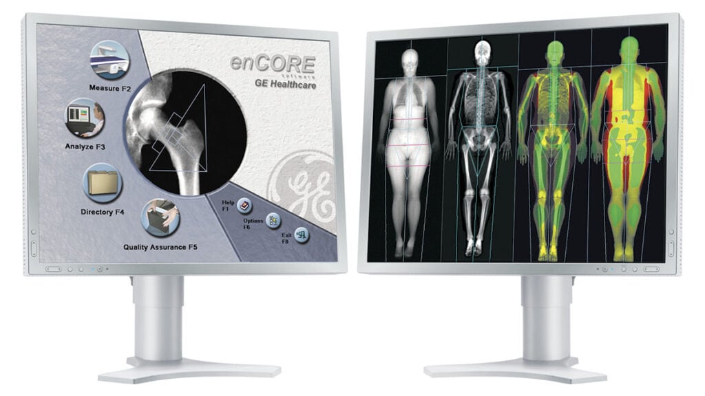 DEXA Body Composition Scan Live Lean Rx Houston Best Pricing