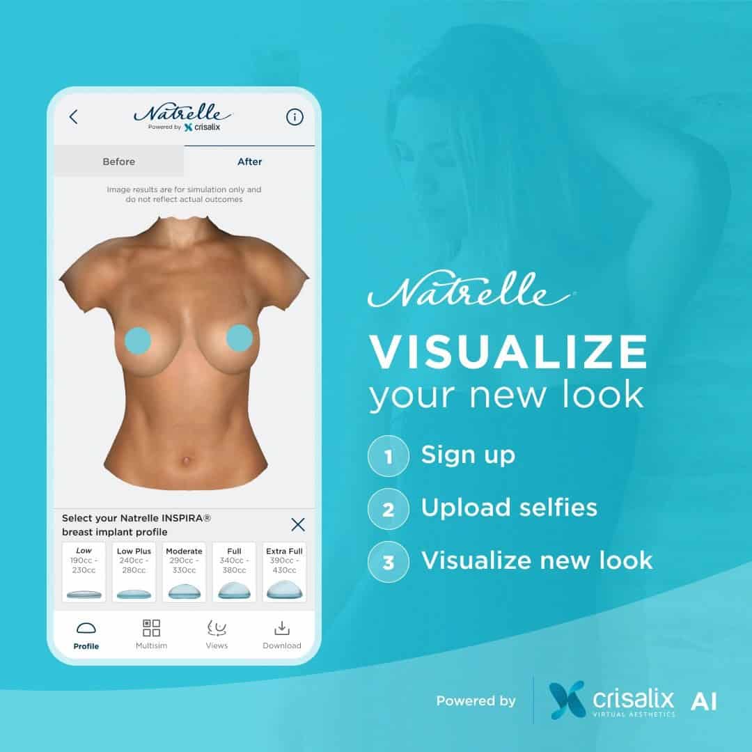 Natrelle Visualizer Breast Implant Preview App | Gemini Plastic Surgery