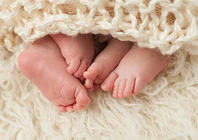 Multiple gestation