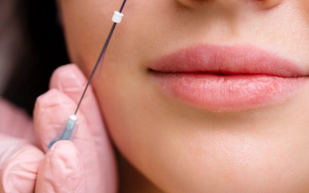 ¿Cómo elegir el hilo correcto según la flacidez y el biotipo del paciente?