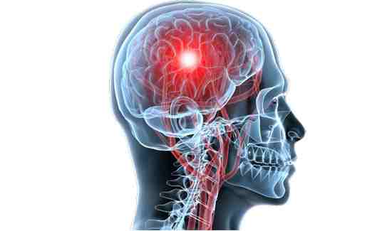 Parkinson’s Disease in the News