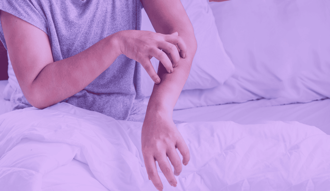 Are These Bed Bug Bites? Signs, Symptoms, and What to Do