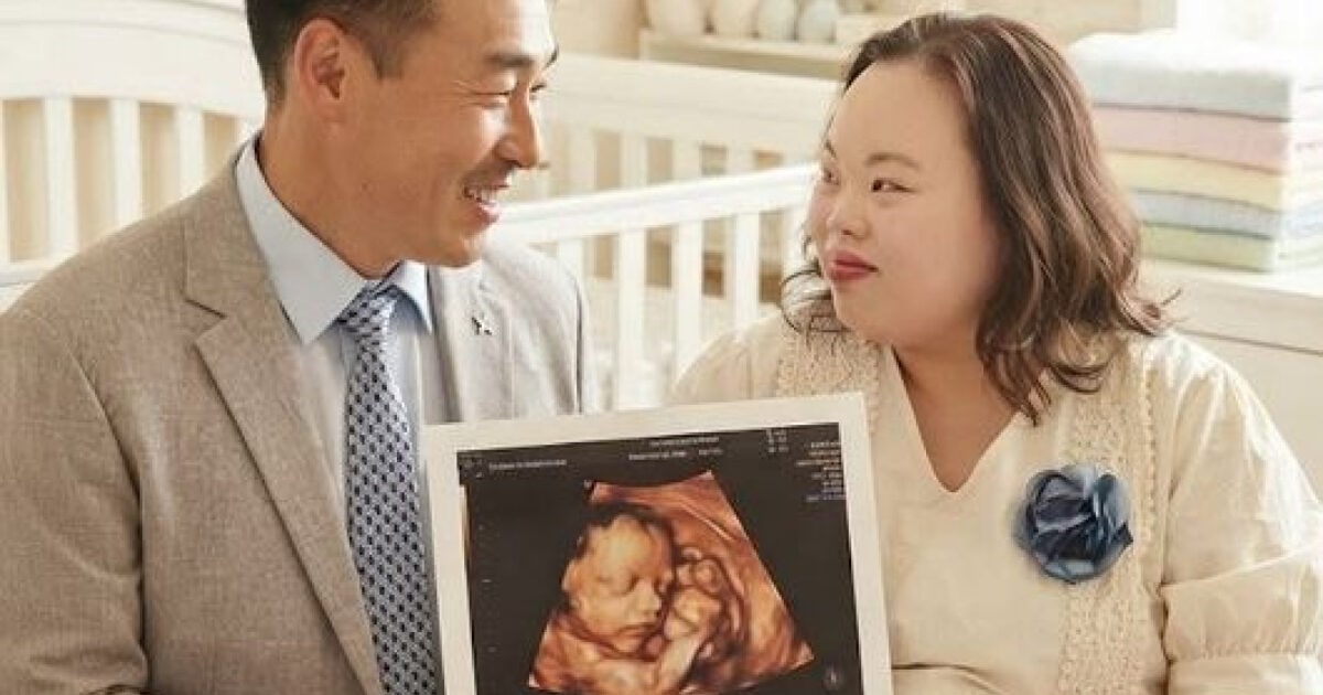 Aktris dengan Down Syndrome Unggah Gambar USG, Picu Kehebohan di Media Sosial