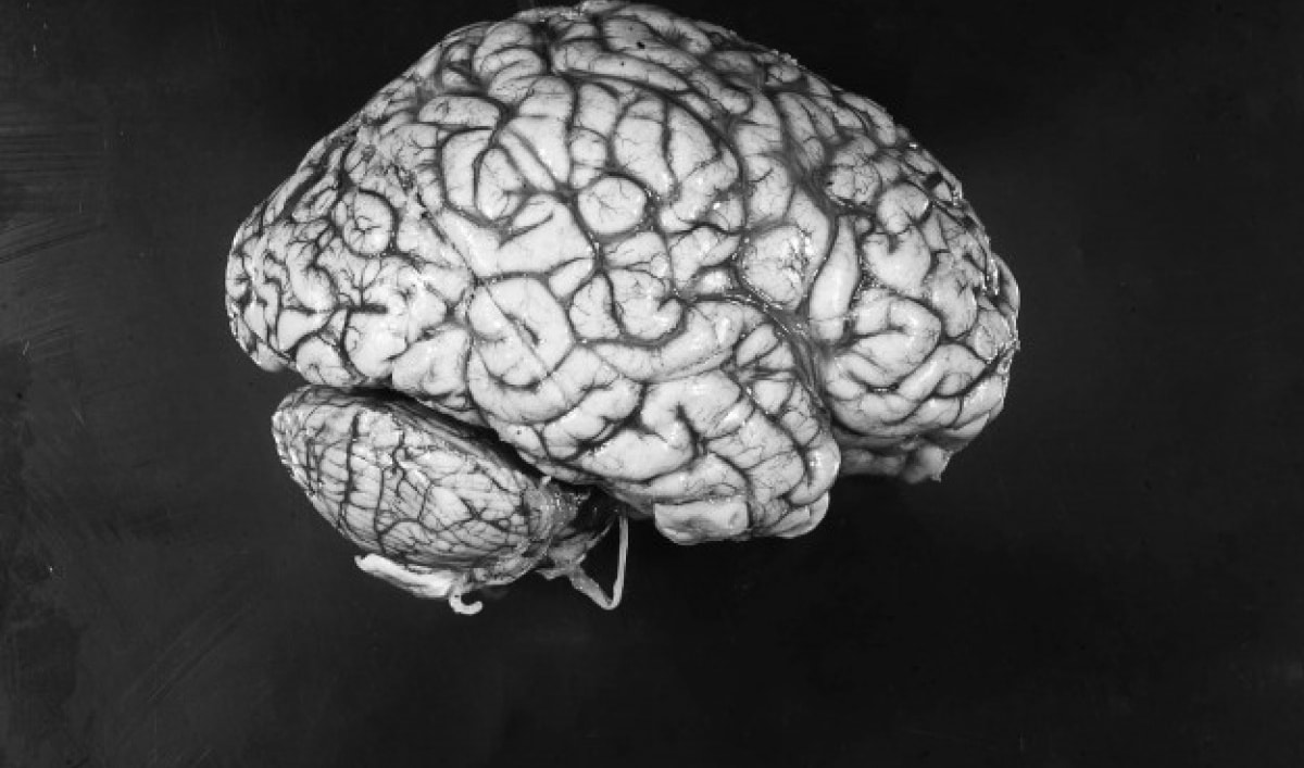 Psychiatry & Neurosciences