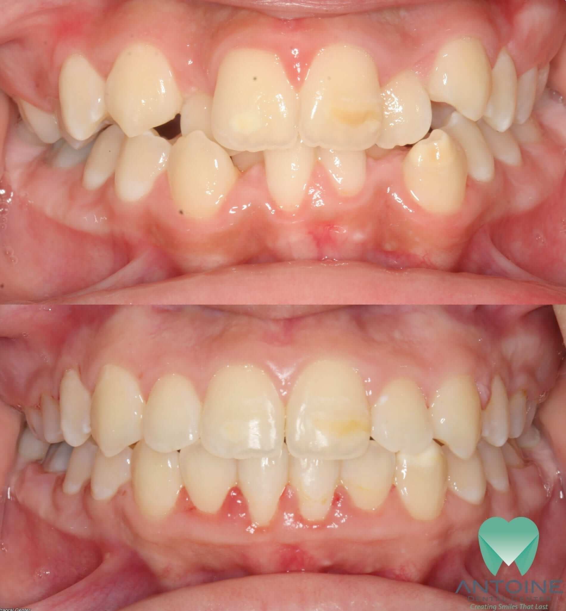 cosmetic dentistry pediatric dentist near me