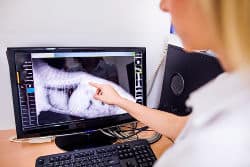 Vet pointing at an x ray of a dog