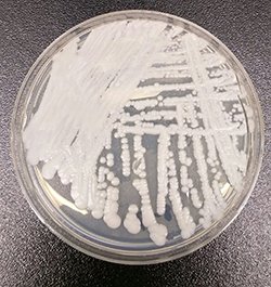 Clinicians Take Note: CDC Warns of Deadly Drug-Resistant Candida auris in the U.S. Clinicians Take Note: CDC Warns of Deadly Drug-Resistant Candida auris in the U.S.