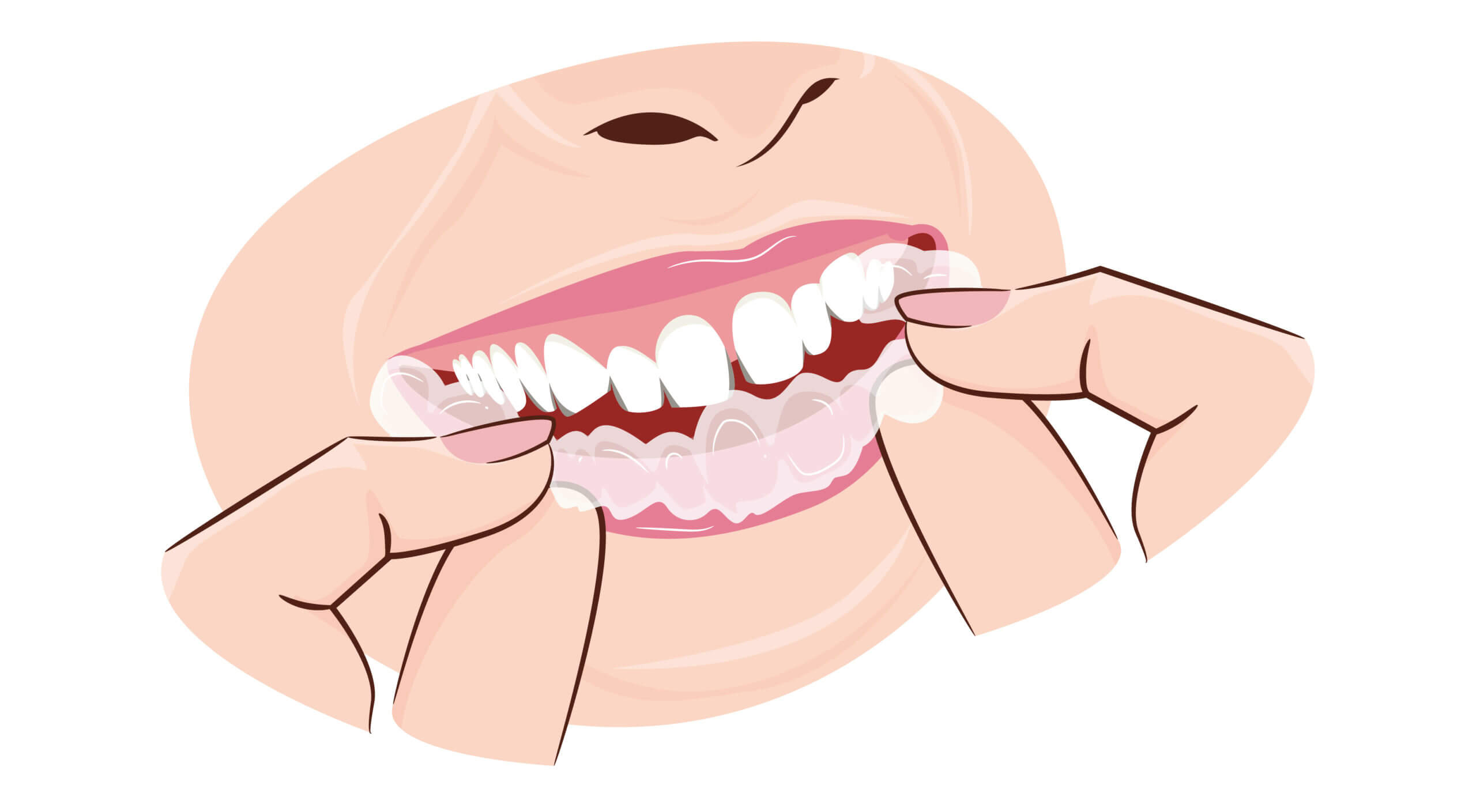 whitening teeth whitening cost