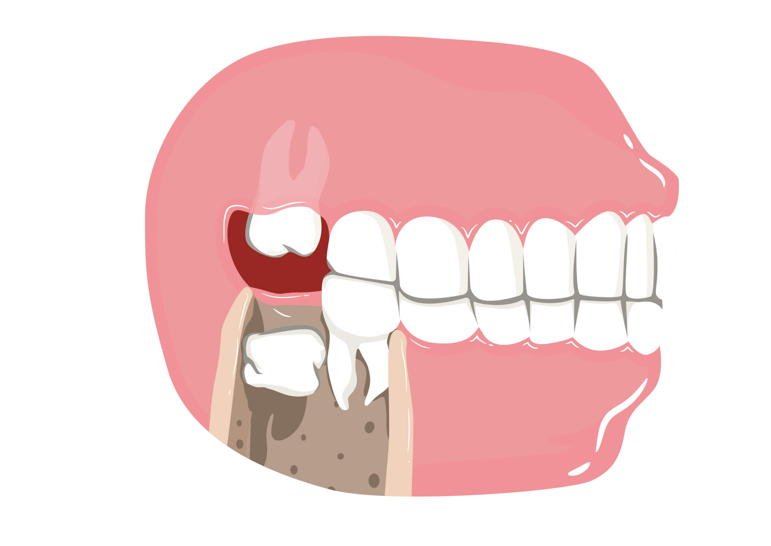 dental surgery sedation dentistry