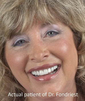 minimum prep or low preparation porcelain veneers testimonials-2
