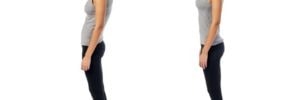 Posture and TMJ Disorder