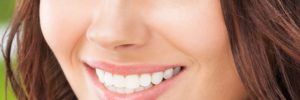 Gum Contouring
