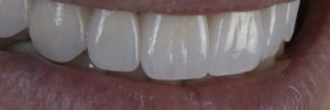 Quality cosmetic dentistry in Chicago