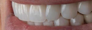 North Shore Prosthodontics