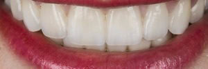 Natural looking PFMs