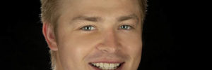 composite veneers