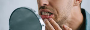 translucent teeth in smile